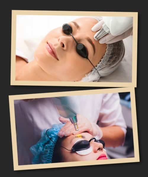 видалення перманентного макіяжу