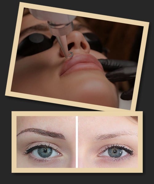 що робити з невдалим татуажем