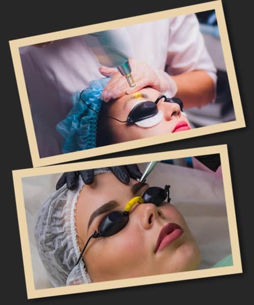 Після лазерного зведення перманентного макіяжу