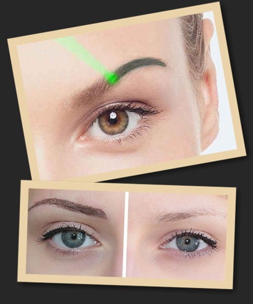 Способи видалення татуажу