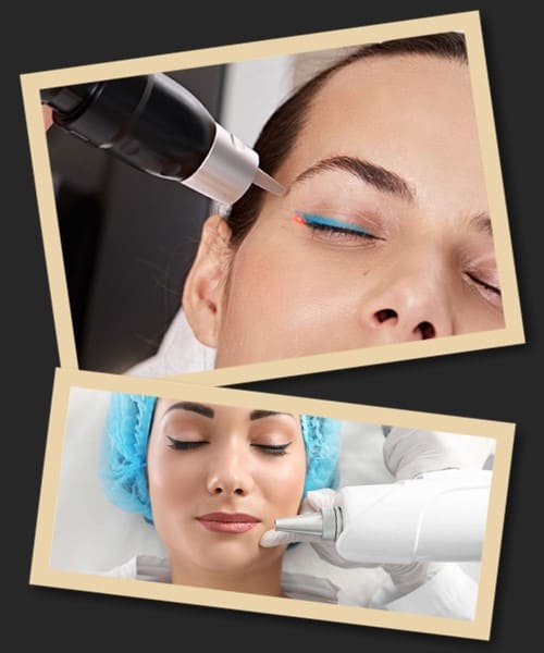 сеанс лазерного видалення татуажу