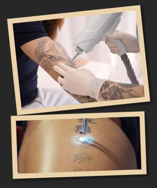 вивести татуювання