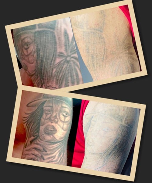 Особливості виведення великого тату