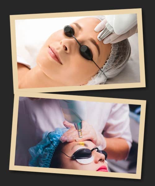 видалення пудрових брів лазером