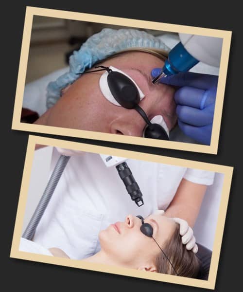 Методика зведення перманентного макіяжу лазером