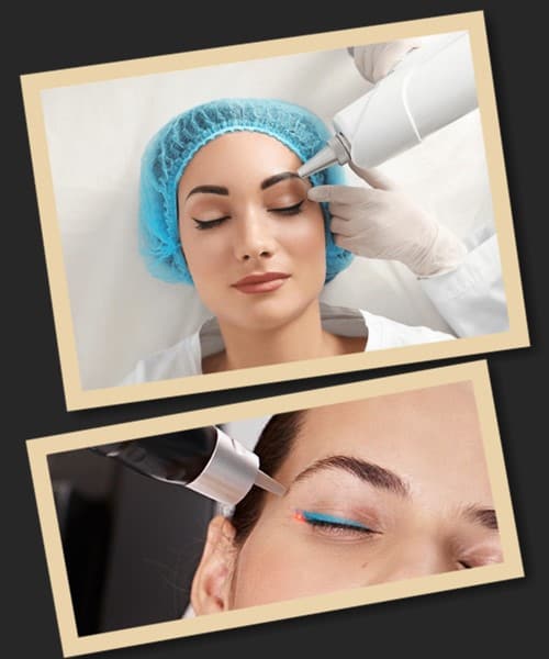 Видалення старого татуажу