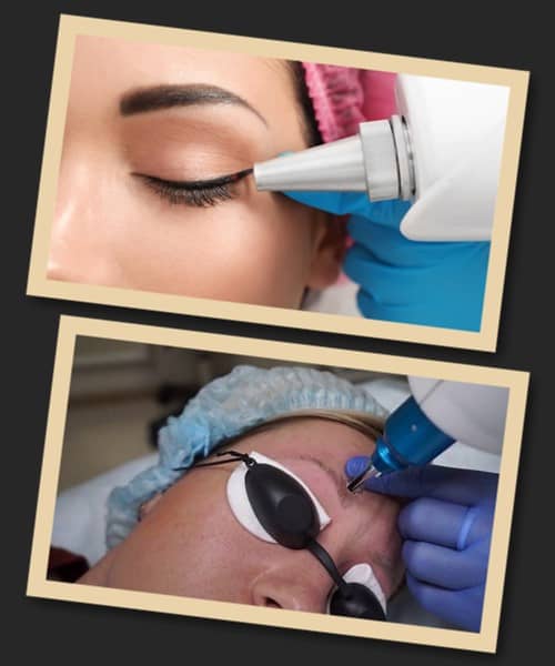 Особливості зведення старого татуажу