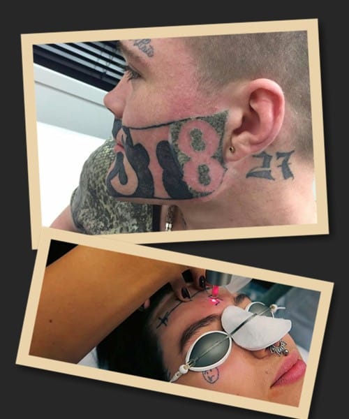 Методи зведення тату