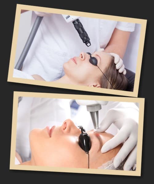 зведення непотрібного татуажу