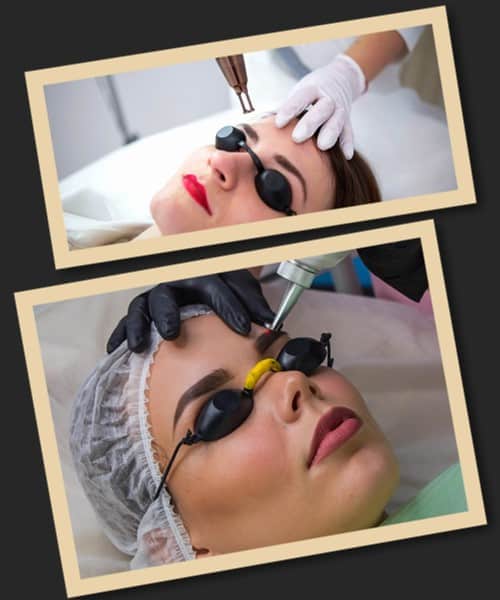 відновлення шкіри після виведення татуажу брів