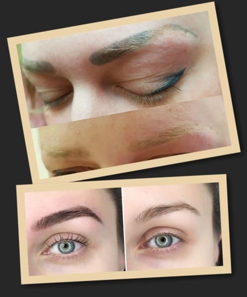 Що таке ремувер і як він працює