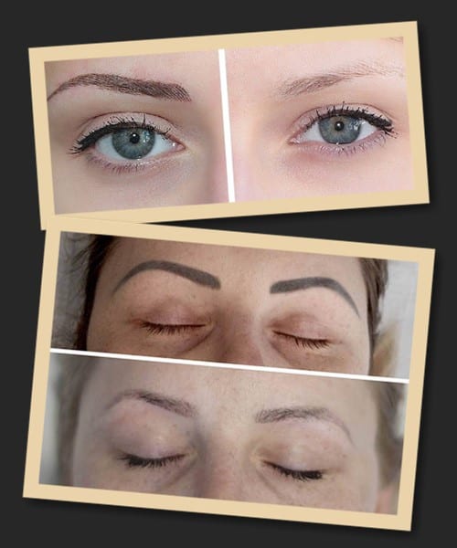 Видалення брів ремувером