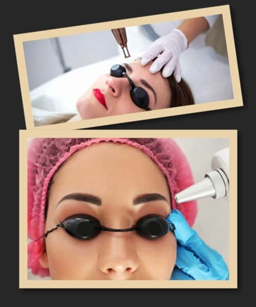 видалення перманентного макіяжу