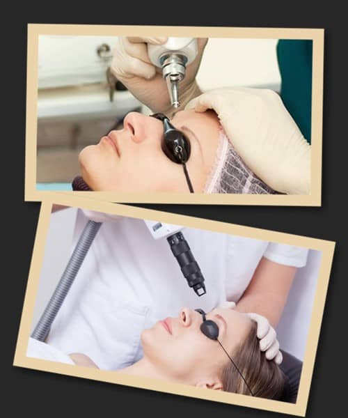 Ефективність лазерного методу зведення татуажу