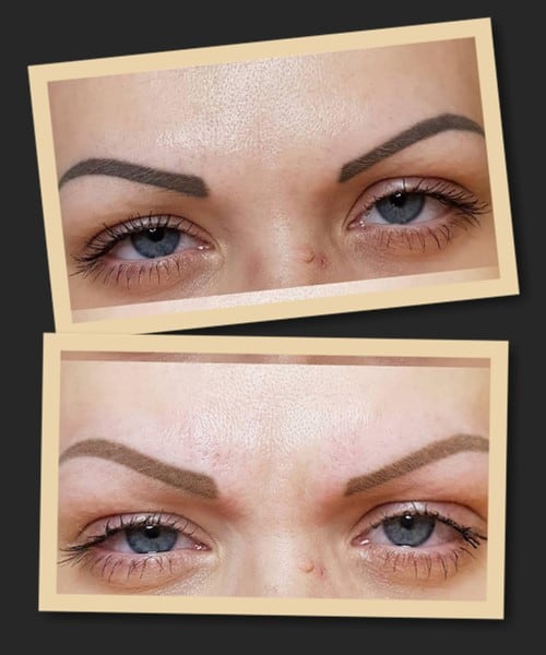 видалення татуажу брів ремувером