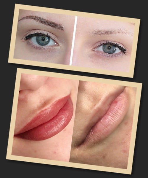 видалення татуажу ремувером фото до та після