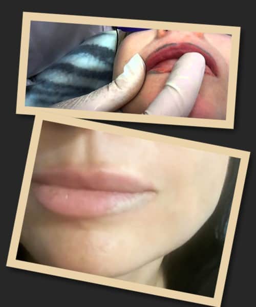 видалення перманенту ремувером