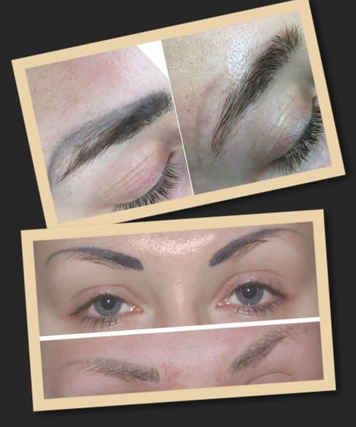 Які види татуажу можна видаляти ремувером