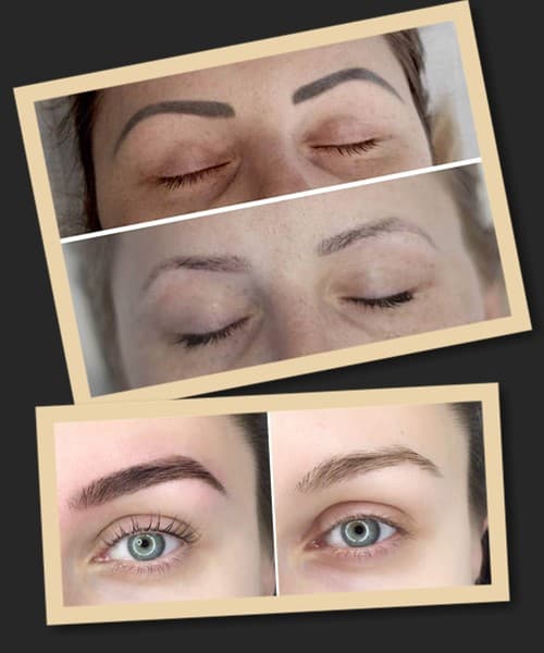 протипоказання до застосування ремуверу