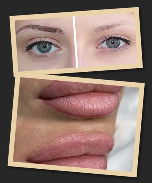 видалення татуажу ремувером