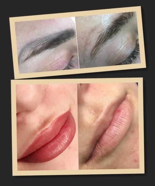 Неякісний татуаж можна звести