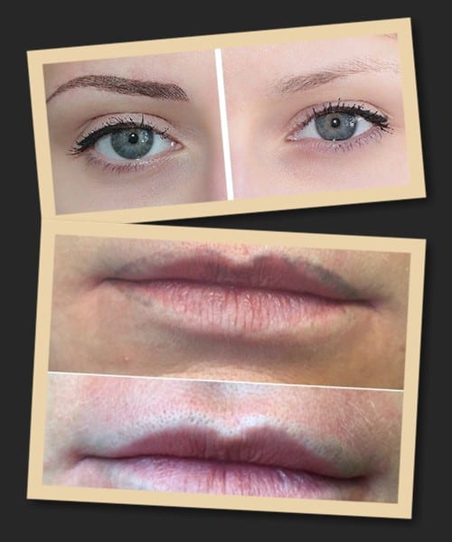 зведення татуажу ремувером