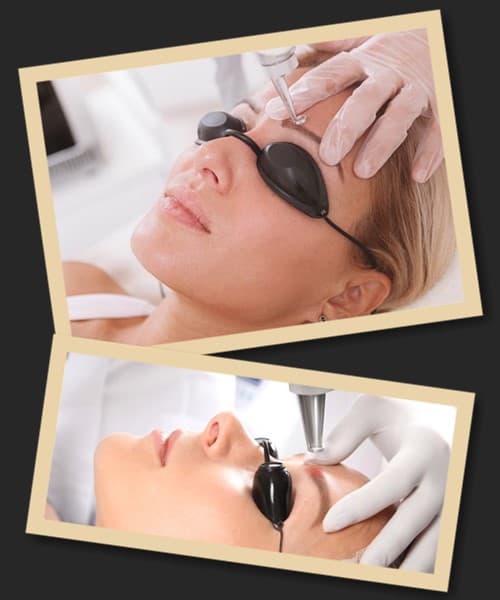 як я видалила татуаж брів