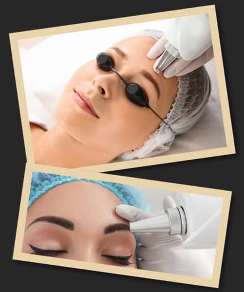 Лазерне видалення татуажу брів відгуки