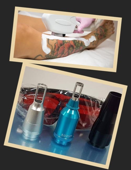 Як безпечно видалити волосся в зоні тату