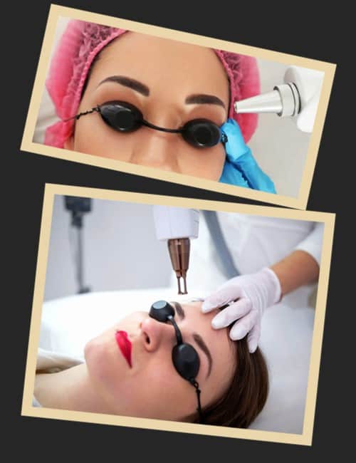 Якими методами видаляють татуаж брів