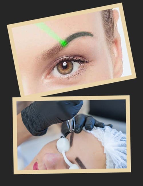 ефективність виведення перманентного макіяжу брів лазером