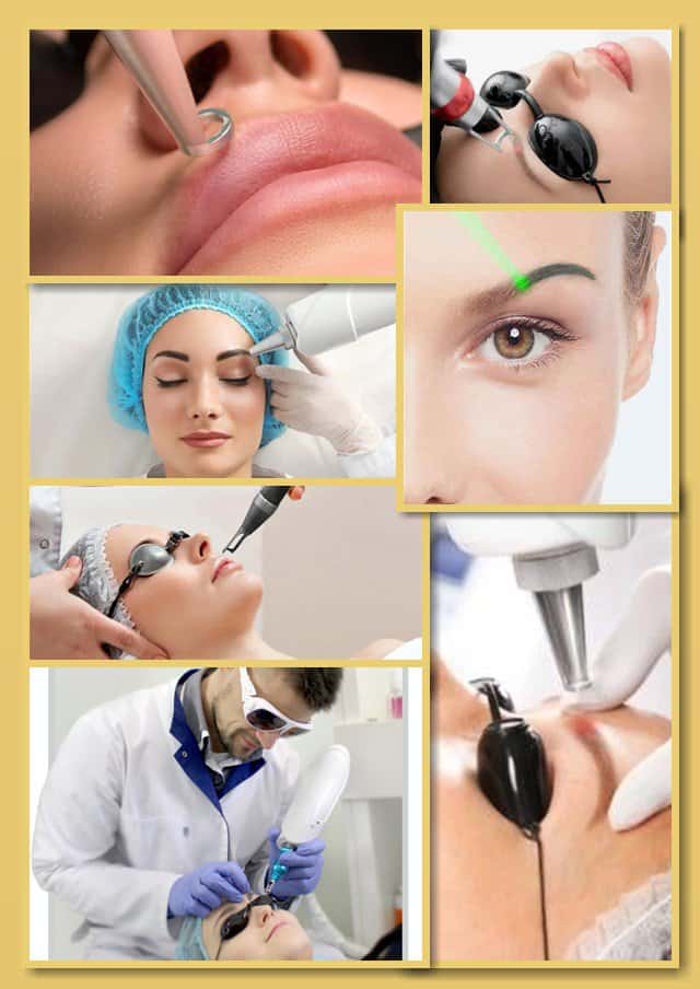 Лазер для видалення татуажу