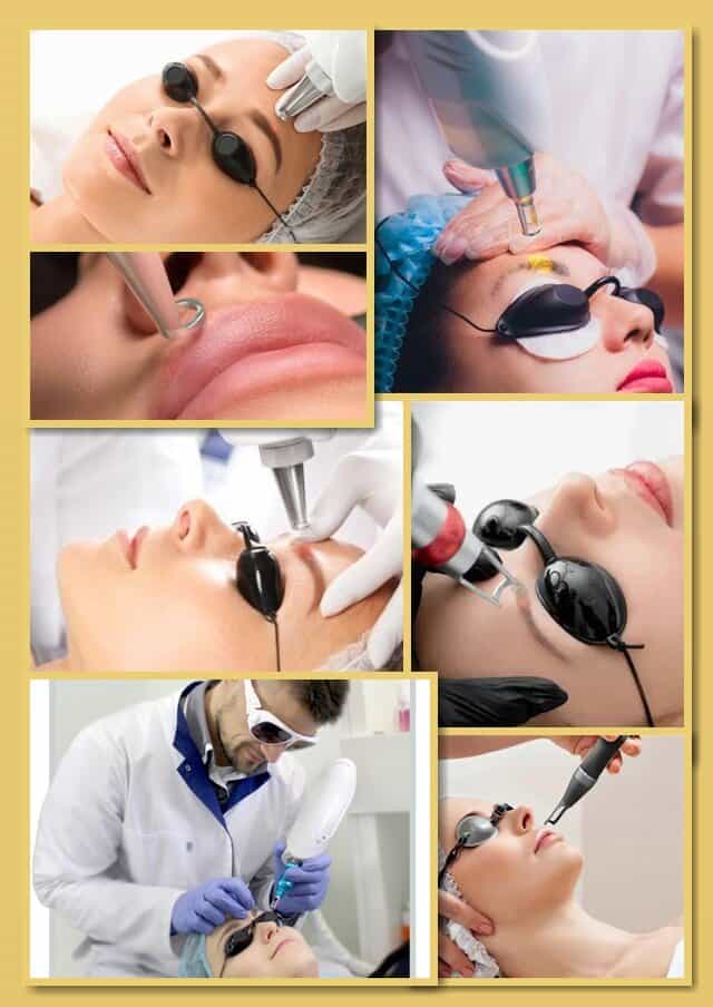 Видалення татуажу лазером