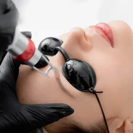 видалити татуаж