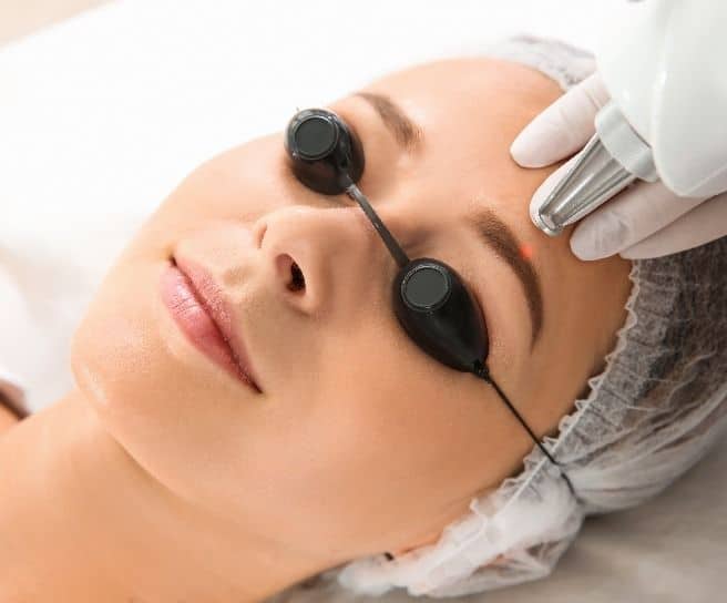 лазерне видалення татуажу