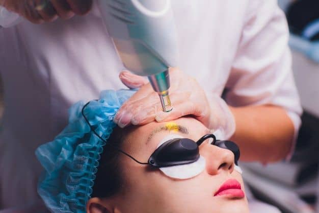 Методи видалення татуажу