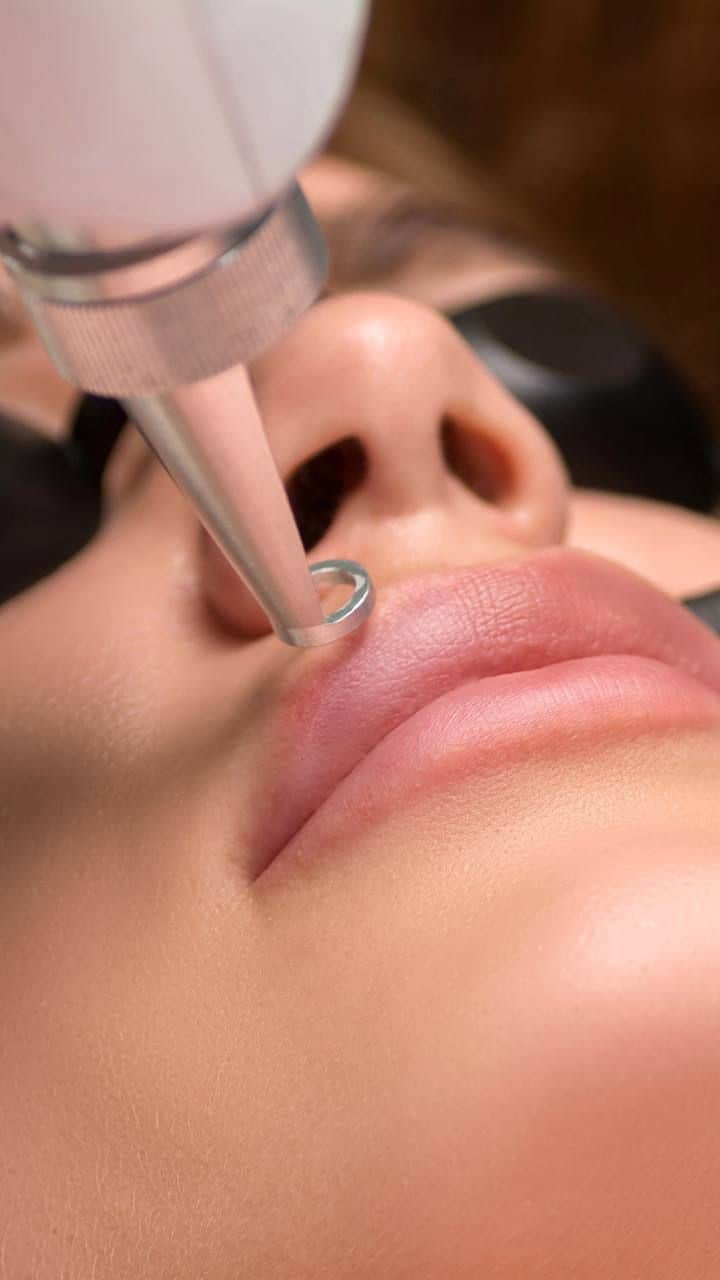 Видалити татуаж на обличчі