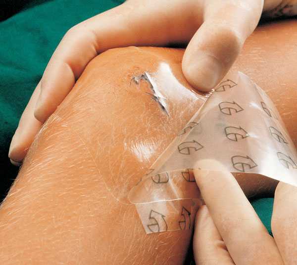 загоєння тату